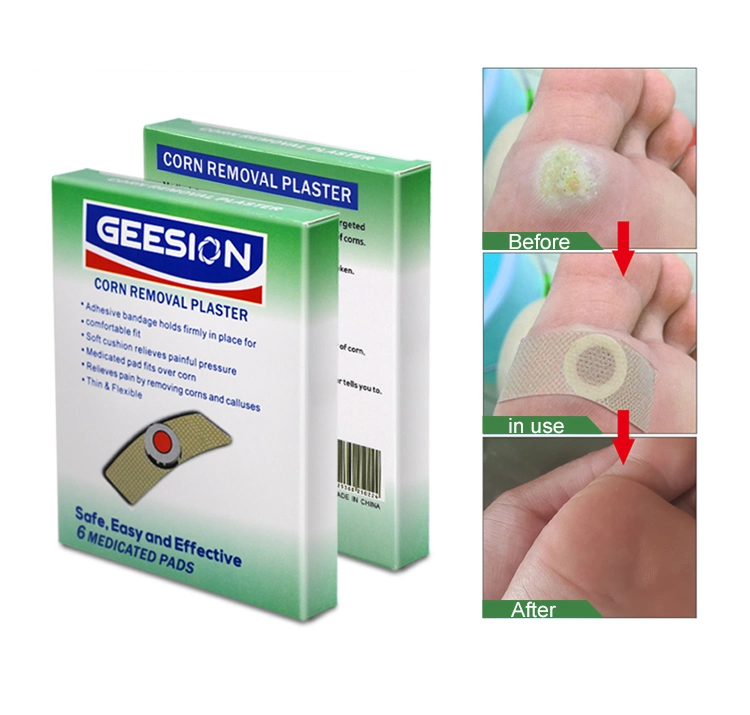 New Products Chinese Manufacturer Medical Adhesive Corn Plaster